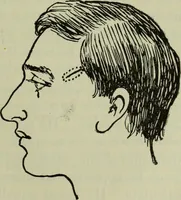 An illustration from The mental functions of the brain : an investigation into their localisation and their manifestation in health and disease (1901)