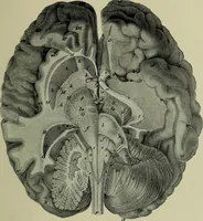 Picture 15 of 36 from The mental functions of the brain : an investigation into their localisation and their manifestation in health and disease (1901), leaf 276