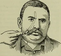 An illustration from The mental functions of the brain : an investigation into their localisation and their manifestation in health and disease (1901)