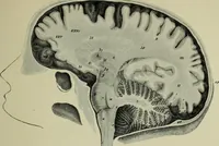An illustration from The mental functions of the brain : an investigation into their localisation and their manifestation in health and disease (1901)