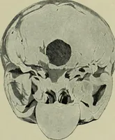 Picture 27 of 36 from The mental functions of the brain : an investigation into their localisation and their manifestation in health and disease (1901), leaf 356