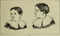 An illustration from The mental functions of the brain : an investigation into their localisation and their manifestation in health and disease (1901)