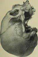 An illustration from The mental functions of the brain : an investigation into their localisation and their manifestation in health and disease (1901)
