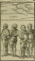 Picture 29 of 32 from Hieronymi Mercvrialis De arte gymnastica libri sex : in quibus exercitationum omnium vetustarum genera, loca, modi, facultates, & quidquid deniq. ad corporis humani exercitationes pertinet, diligenter explicatur .. (1573), leaf 174
