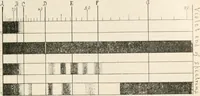 An illustration from The microscope : an introduction to microscopic methods and to histology (1911)
