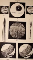 An illustration from The microscope and its revelations (1891)