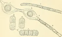 An illustration from The microscope and its revelations (1856)