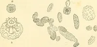 An illustration from The microscope and its revelations (1856)