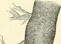 An illustration from The microscope and its revelations (1856)