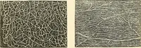 An illustration from The microscope and its revelations (1856)