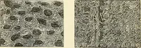An illustration from The microscope and its revelations (1856)
