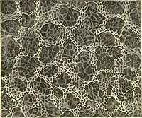 An illustration from The microscope and its revelations (1856)