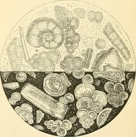 An illustration from The microscope and its revelations (1856)