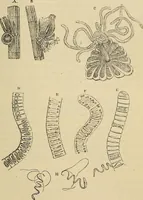 An illustration from The microscope and its revelations (1881)