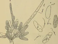 An illustration from The microscope and its revelations (1881)