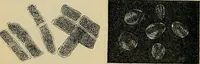 An illustration from The microscope and its revelations (1881)