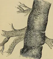 An illustration from The microscope and its revelations (1881)
