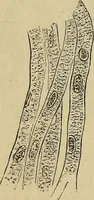 An illustration from The microscope and its revelations (1881)