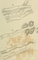 Picture 70 of 209 from Mikroskopische Bilder : Naturansichten aus dem kleinsten Raume ; ein Gemälde des Mikrokosmus in seinen Gestalten und Gesetzen (1853), leaf 246