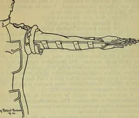 Picture 2 of 25 from Military surgery of the zone of the advance (1918), leaf 241