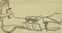 An illustration from Military surgery of the zone of the advance (1918)