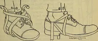 An illustration from Military surgery of the zone of the advance (1918)