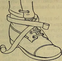 An illustration from Military surgery of the zone of the advance (1918)