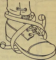 An illustration from Military surgery of the zone of the advance (1918)
