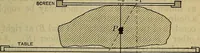An illustration from Military surgery of the zone of the advance (1918)