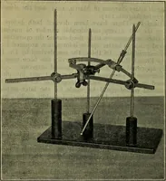 An illustration from Military surgery of the zone of the advance (1918)
