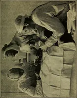 An illustration from Military surgery of the zone of the advance (1918)