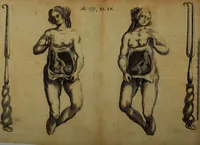 An illustration from Miscellanea Curiosa Medico-Physica Academiae Naturae Curiosorum (1670)