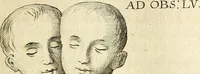 Picture 19 of 35 from Miscellanea Curiosa Medico-Physica Academiae Naturae Curiosorum (1670), leaf 198