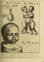 An illustration from Miscellanea Curiosa, sive Ephemiridum Medico-Physicarum Germanicarum Academiae Naturae Curiosorum (1694)