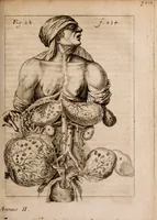 An illustration from Miscellanea curiosa, sive, Ephemeridum medico-physicarum Germanicarum Academiae Naturae curiosorum (1683)