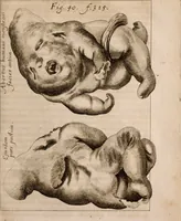 An illustration from Miscellanea curiosa, sive, Ephemeridum medico-physicarum Germanicarum Academiae Naturae curiosorum (1683)