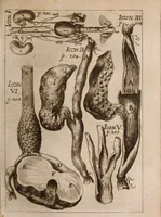 An illustration from Miscellanea curiosa, sive, Ephemeridum medico-physicarum Germanicarum Academiae Naturae curiosorum (1683)