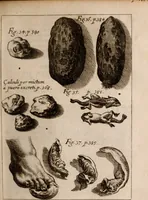 An illustration from Miscellanea curiosa, sive, Ephemeridum medico-physicarum Germanicarum Academiae Naturae curiosorum (1683)