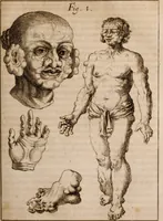 Picture 70 of 97 from Miscellanea curiosa, sive, Ephemeridum medico-physicarum Germanicarum Academiae Naturae curiosorum (1683), leaf 756