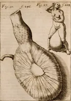 An illustration from Miscellanea curiosa, sive, Ephemeridum medico-physicarum Germanicarum Academiae Naturae curiosorum (1683)