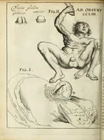 Picture 63 of 70 from Miscellanea Curiosa Medico-Physica Academiae Naturae Curiosorum (1671), leaf 527