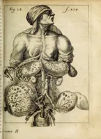Picture 12 of 18 from Miscellanea Curiosa, sive Ephemiridum Medico-Physicarum Germanicarum Academiae Naturae Curiosorum (1684), leaf 287
