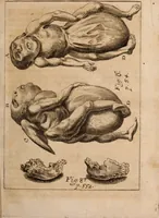 An illustration from Miscellanea curiosa, sive, Ephemeridum medico-physicarum Germanicarum Academiae Naturae curiosorum (1688)