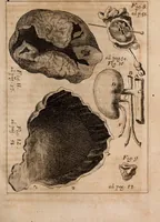 An illustration from Miscellanea curiosa, sive, Ephemeridum medico-physicarum Germanicarum Academiae Naturae curiosorum (1688)