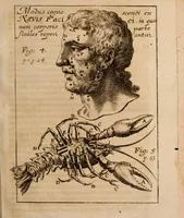 An illustration from Miscellanea curiosa, sive, Ephemeridum medico-physicarum Germanicarum Academiae Naturae curiosorum (1688)