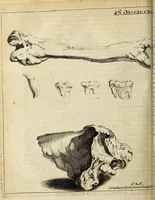 An illustration from Miscellanea Curiosa Medico-Physica Academiae Naturae Curiosorum (1672)