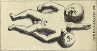 An illustration from Miscellanea Curiosa Medico-Physica Academiae Naturae Curiosorum (1672)