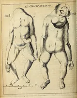 An illustration from Miscellanea Curiosa Medico-Physica Academiae Naturae Curiosorum (1672)
