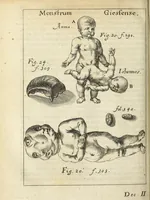 An illustration from Miscellanea Curiosa, sive Ephemiridum Medico-Physicarum Germanicarum Academiae Naturae Curiosorum (1685)