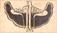 An illustration from Miscellanea curiosa, sive, Ephemeridum medico-physicarum Germanicarum (1700)